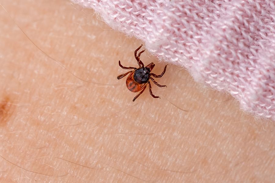 Tick bites on people